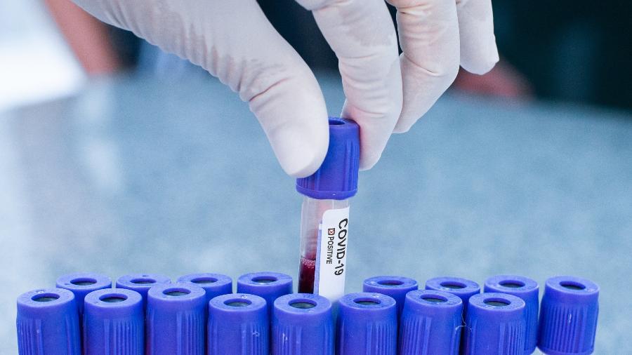Empresas testam covid-19 para volta ao escritório; imunidade não é certeza