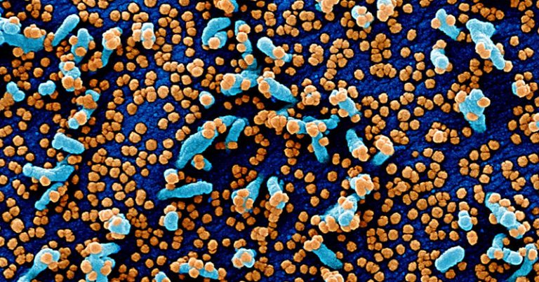 Cientistas reforçam alerta para risco de contaminação da covid-19 por micropartículas