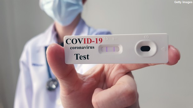 APS dá início a testagem dos empregados para covid-19